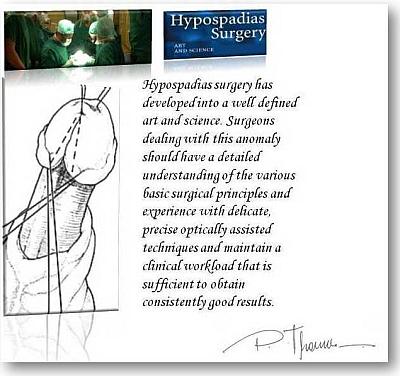 hypospadias_2